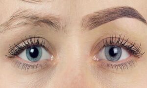 کاشت ابرو eyebrow implantation